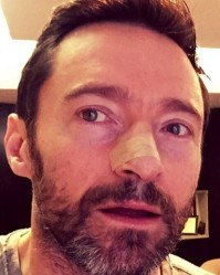 Hugh Jackman