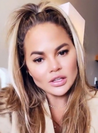 Chrissy Teigen